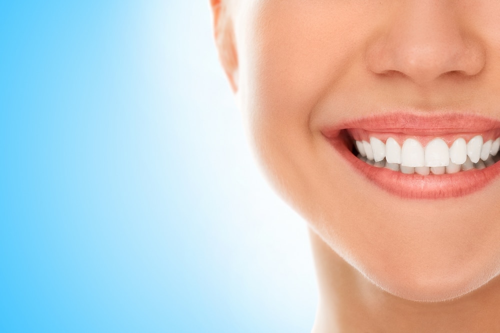 teeth whitening concord nc