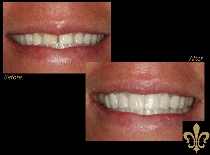 See some of our before and after images of REAL patients!